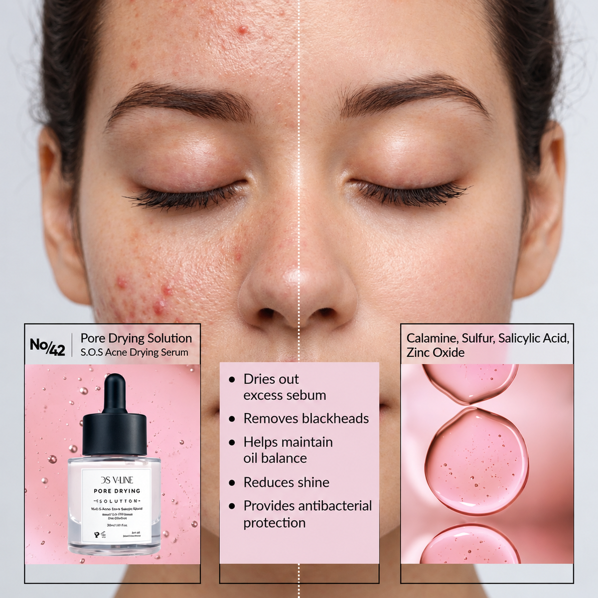 42 Sebum Balancing Sulfur Serum