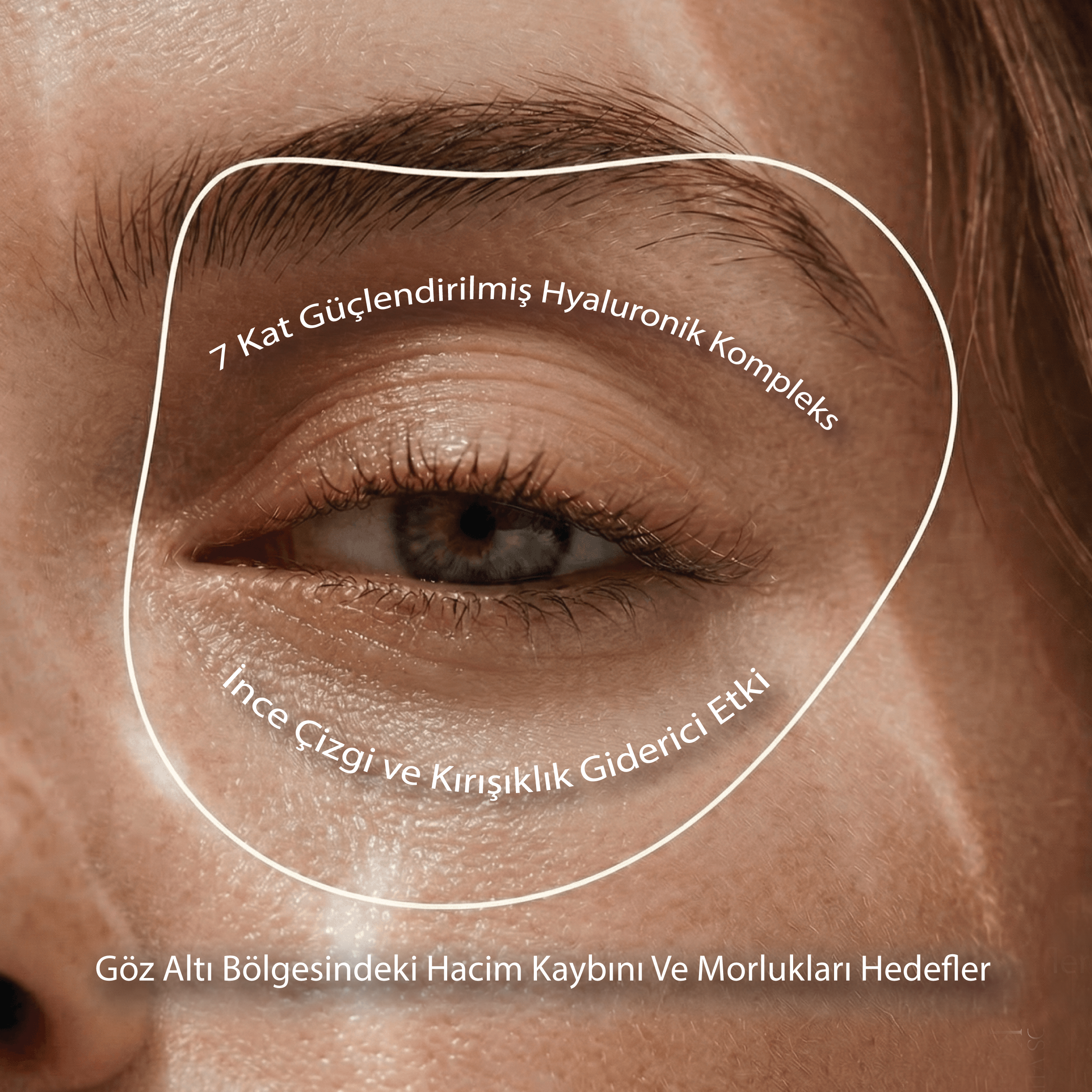 HYA THREAD Volumen-Fadenpflege-Set